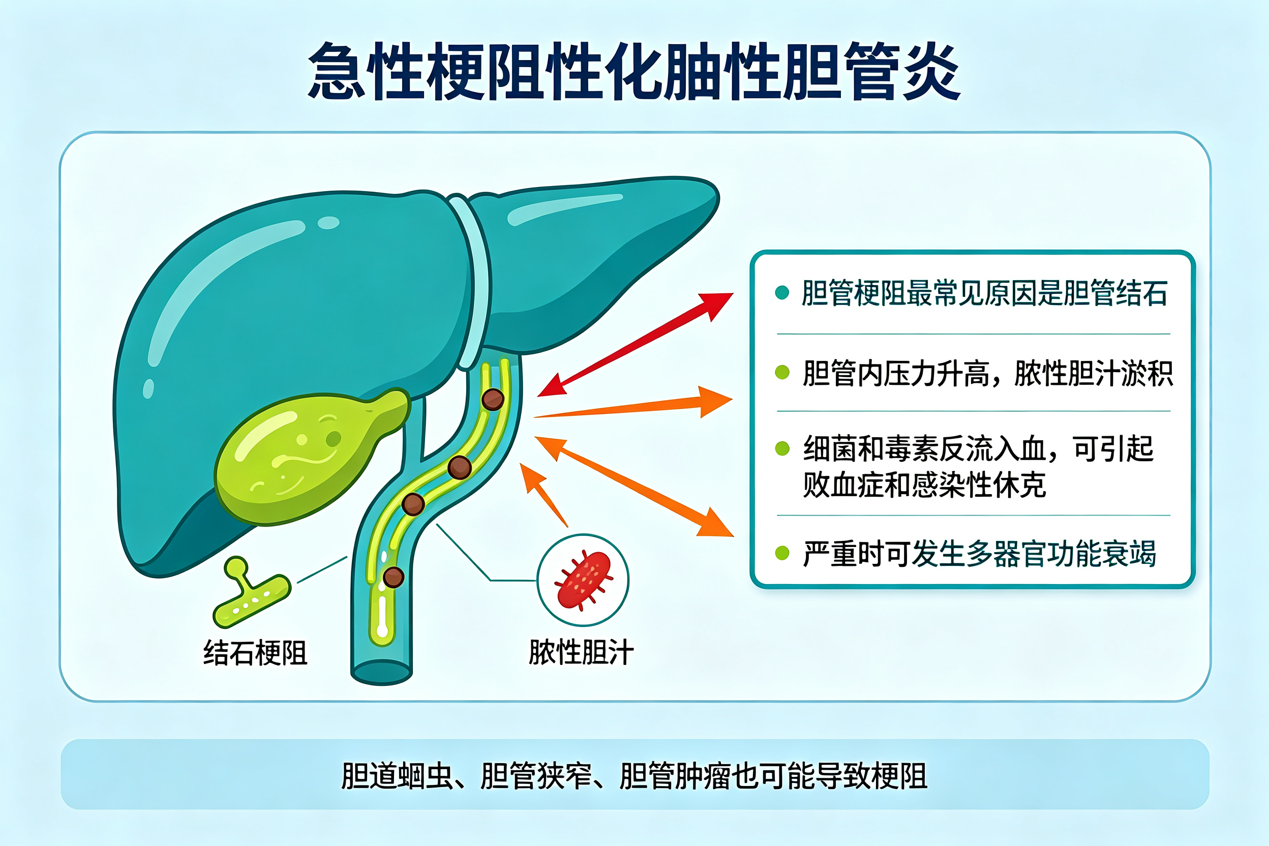 腹痛、黄疸、高烧,这个急症很凶险——急性梗阻性化脓性胆管炎