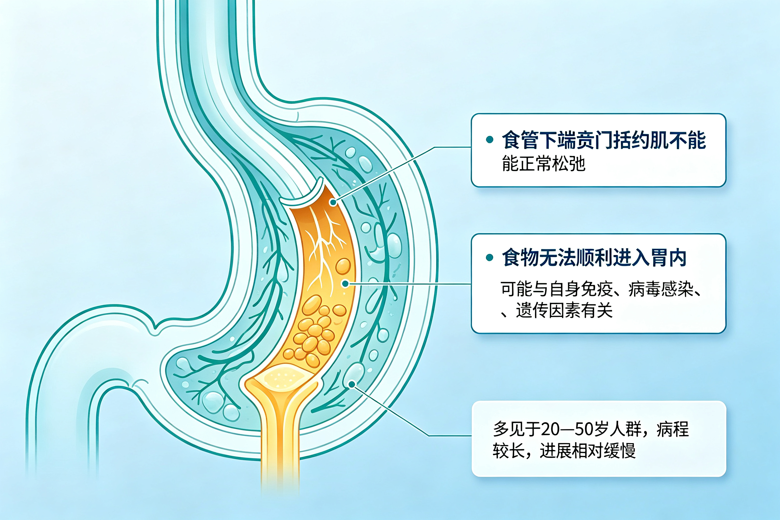 吞咽困难、食物反流,不一定是食道癌——认识贲门失弛缓症