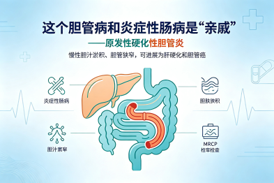 这个胆管病和炎症性肠病是"亲戚"——原发性硬化性胆管炎