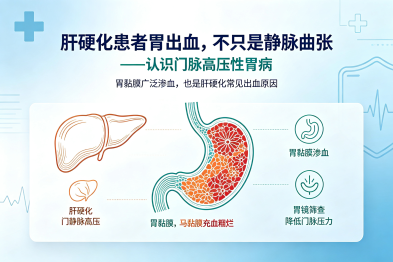 肝硬化患者胃出血，不只是静脉曲张——认识门脉高压性胃病