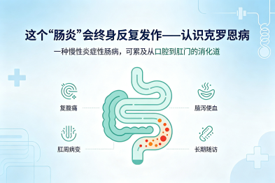 这个"肠炎"会终身反复发作——认识克罗恩病