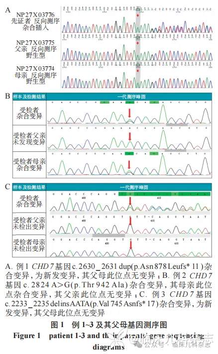 CHD7 基因变异致 CHARGE 综合征临床特征及遗传学分析