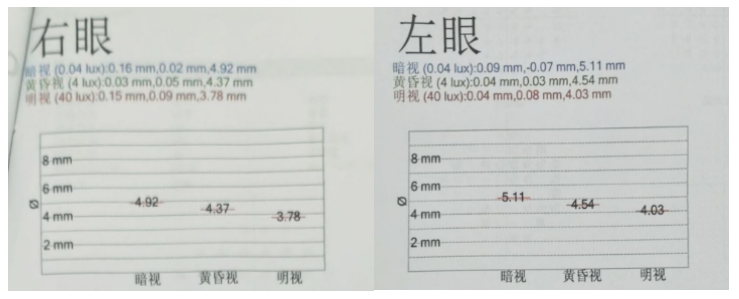 1200 度近视、前房偏浅又暗瞳偏大,摘镜方案如何取舍?
