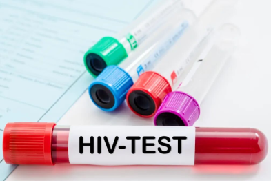 HIV 初筛有反应，就是确诊艾滋病吗？这份报告越早知道越好