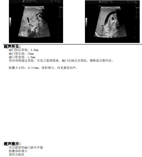 极速诊治抢生机|21 天新生儿遭遇消化道畸形,瑞康医院儿科精准研判打通生命转诊通道