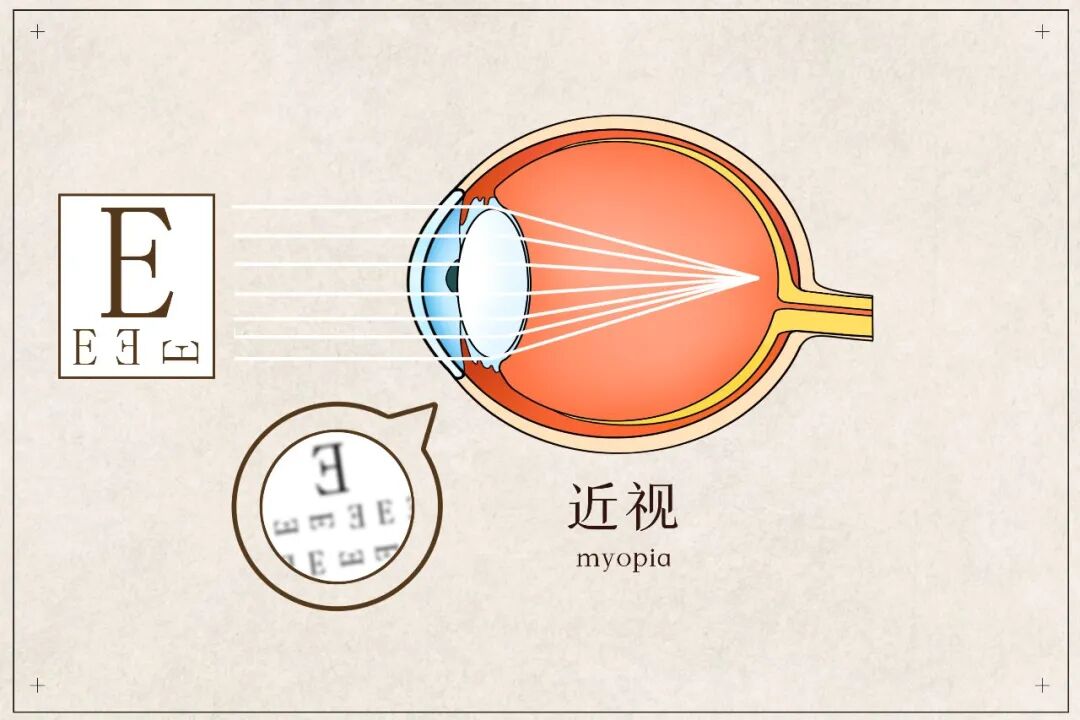 读写灯具怎么选?卫健委发布会给出建议——北京华厦民众眼科医院苏金萍提醒:灯光是辅助,视力管理要跟上
