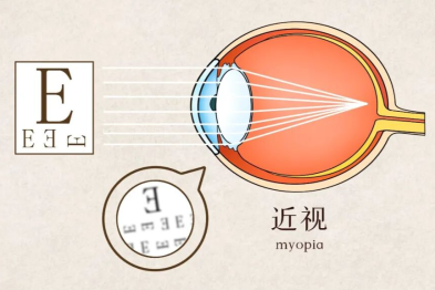 读写灯具怎么选？卫健委发布会给出建议——北京华厦民众眼科医院苏金萍提醒：灯光是辅助，视力管理要跟上