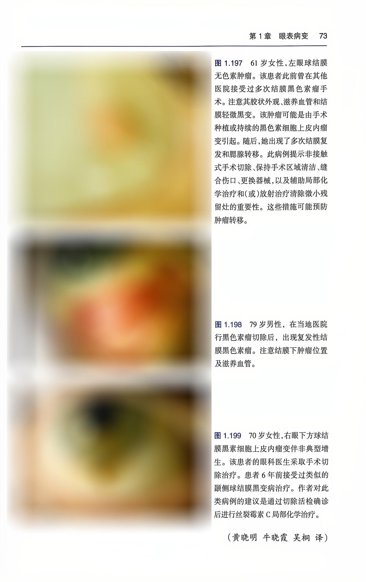 共享全球眼科智慧 | 孙丰源院长主审《临床眼肿瘤图谱》中文译版出版