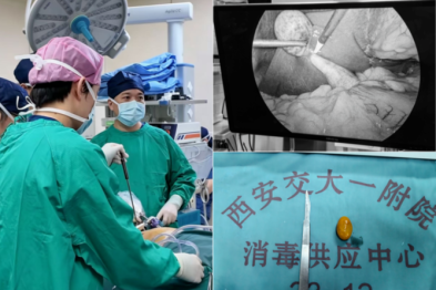 陆港院区腹部外科成功救治六旬危重肝内外胆管结石患者