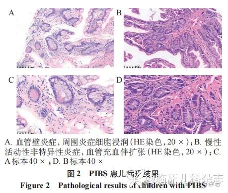 儿童肠型贝赫切特综合征 13 例病例系列分析