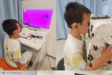 半年 25 次视觉训练｜8 岁近视男孩视功能显著改善，眼轴小幅回退