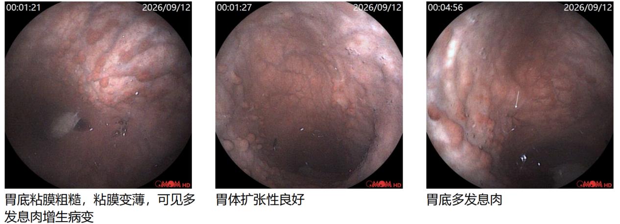 把「医生」吞进肚里做检查是种什么体验?
