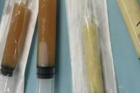 盲目喝浓汤大补，老人突发 40℃ 高烧进 ICU！