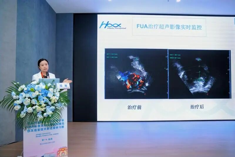 授牌启新程,学术共研讨——桂林妇产年会共探聚焦超声妇科微无创应用