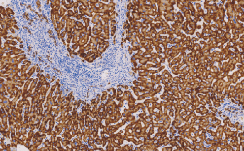 鼠抗人H*BsAg单克隆抗体  TDCHM-0121