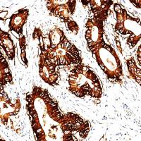 中杉金桥  ZA-0630  钙黏附蛋白17Cadherin抗体试剂（免疫组织化学）
