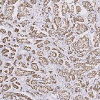 鼠抗人GATA3单克隆抗体  TDCGM-0130