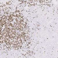 兔抗人ERCC1单克隆抗体 TDCER-0060