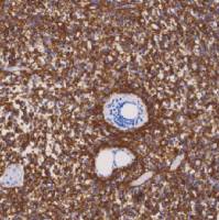 鼠抗人胶质纤维酸性蛋白单克隆抗体  TDCGM-0150