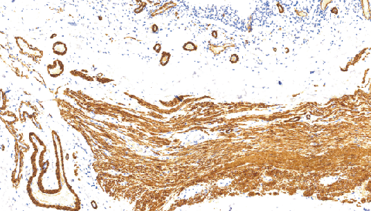 鼠抗人上皮膜抗原单克隆抗体 TDCEM-0041