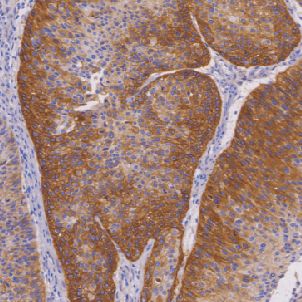 兔抗人表皮生长因子受体单克隆抗体  TDCER-0032