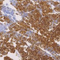 鼠抗人GlypiCAn-3单克隆抗体  TDCGM-0200