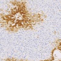 鼠抗人谷氨酰氨合成酶单克隆抗体 TDCGM-0190