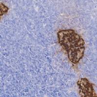 兔抗人胰高血糖素单克隆抗体  TDCGR-0160