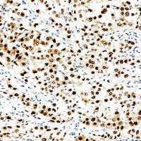 中杉金桥 ZA-0665 HSP70抗体试剂(免疫组织化学)