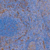 鼠抗人成束蛋白单克隆抗体  TDCFM-0031