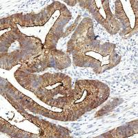 中杉金桥 ZA-0575 Villin(微管素)抗体试剂(免疫组织化学)