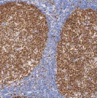 鼠抗人EZH2单克隆抗体 TDCEM-0090