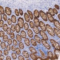 鼠抗人上皮特异性抗原单克隆抗体 TDCEM-0051