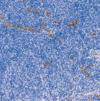 鼠抗人第八因子相关抗原单克隆抗体  TDCFM-0020