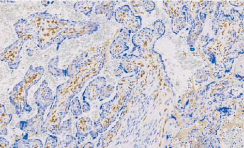 兔抗人凝血因子XIIIa单克隆抗体 TDCFR-0010