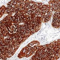 中杉金桥 ZA-0683 细胞角蛋白5&6抗体试剂(免疫组织化学)