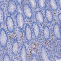 兔抗人ERG单克隆抗体  TDCER-0070