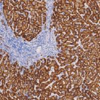 鼠抗人HBsAg单克隆抗体  TDCHM-0121