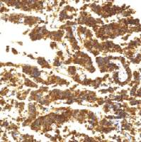 兔抗人卵泡刺激素单克隆抗体  TDCFR-0070