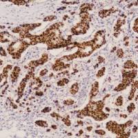 鼠抗人雌激素受体单克隆抗体  TDCEM-0081