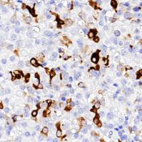 中杉金桥 ZA-0640 促甲状腺素Thyroid Stimulating Hormone抗体试剂 (免疫组织化学)