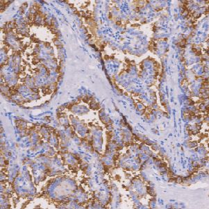 鼠抗人间皮细胞单克隆抗体  TDCHM-0110