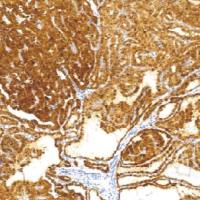 兔抗人半乳凝集素-3单克隆抗体  TDCGR-0101