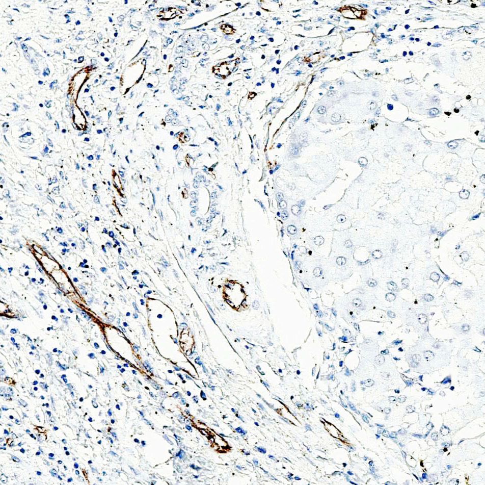 中杉金桥  ZA-0568  CD31内皮细胞标记CD31抗体试剂（免疫组织化学）
