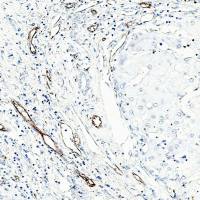 中杉金桥  ZA-0568  CD31内皮细胞标记CD31抗体试剂（免疫组织化学）