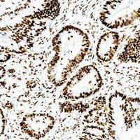 中杉金桥  ZA-0622  MSH2抗体试剂（免疫组织化学）