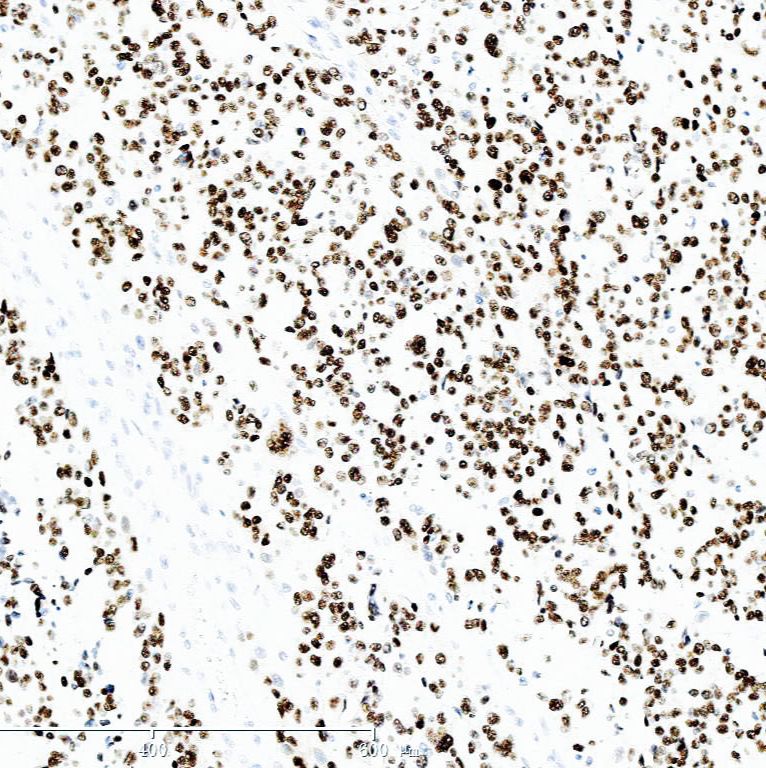 中杉金桥  ZA-0624  SOX10蛋白 抗体试剂（免疫组织化学）