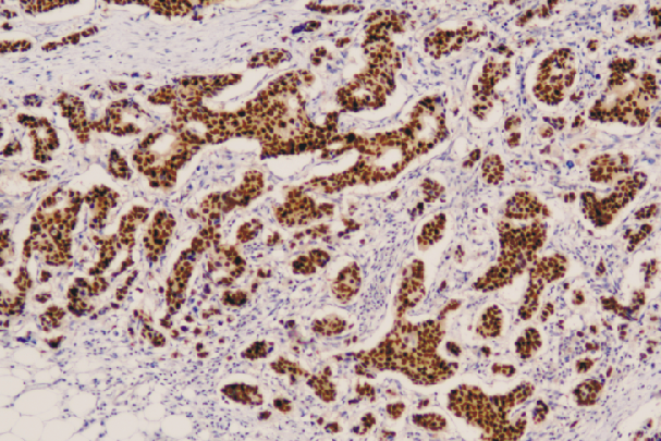 鼠抗人雌激素受体单克隆抗体  TDCEM-0081