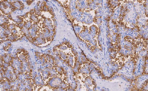 鼠抗人间皮细胞单克隆抗体 TDCHM-0110