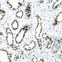 中杉金桥  ZA-0661  GATA3抗体试剂（免疫组织化学）